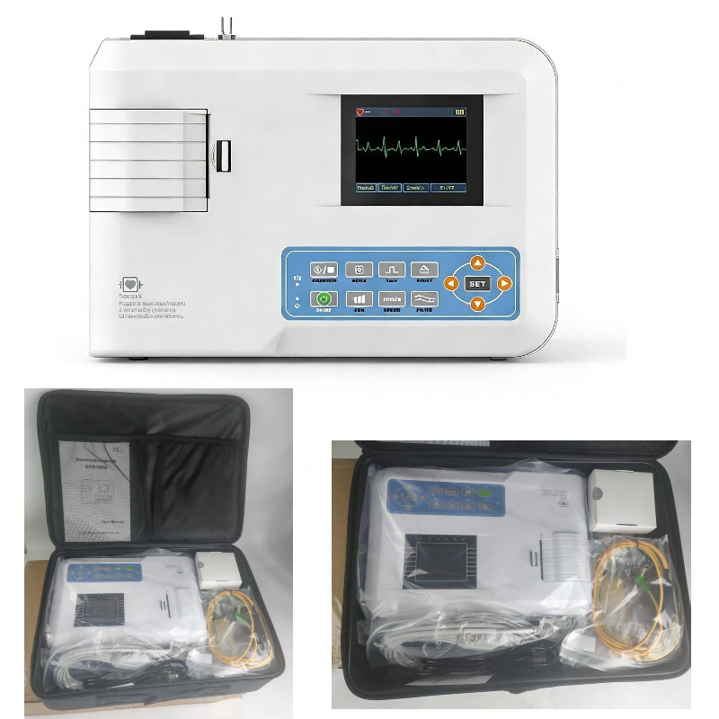 Medical ECG100G Electrocardiograph – 1-Channel 12-Lead Digital EKG Machine