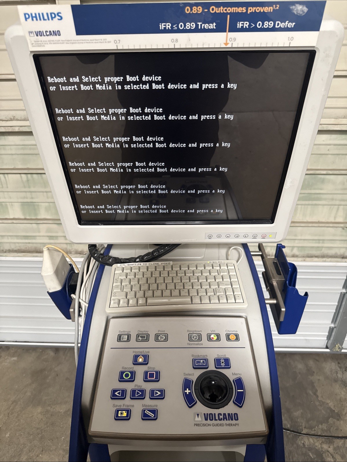 Philips Volcano CORE Mobile Precision Guided Therapy Navigation – No HD