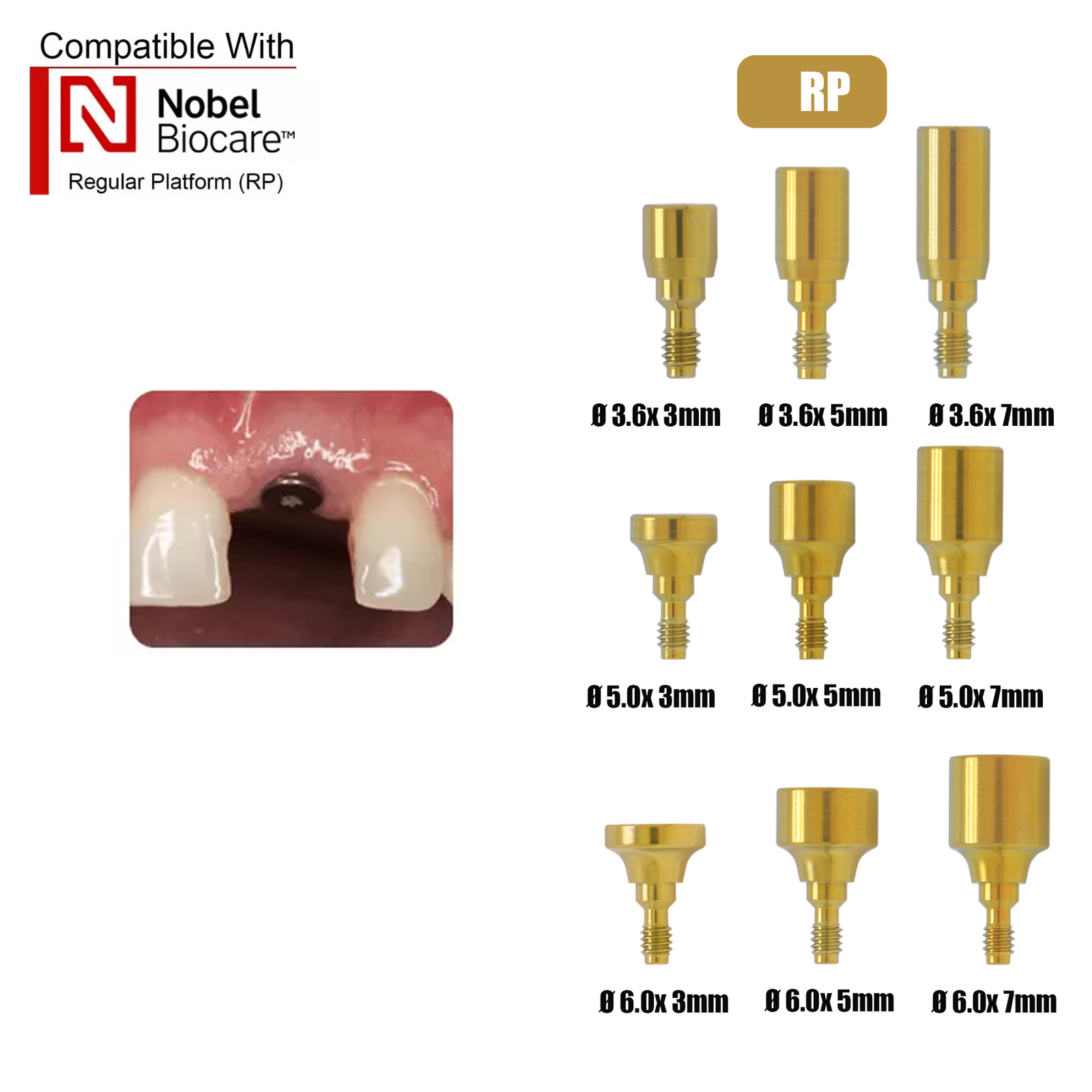 US Fits Nobel Biocare Kit Locator/Healing Abutments Scan Bodies Lab Analog NP/RP