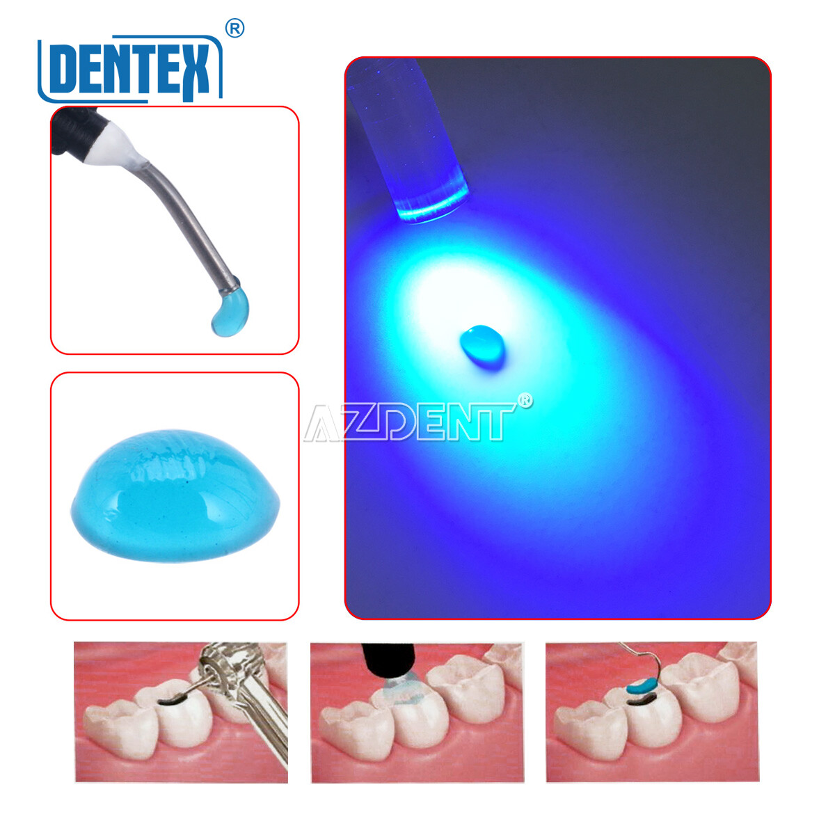 Dental Temporary Flow Light Cure Filling Composite Material Resin Blue Dentex US