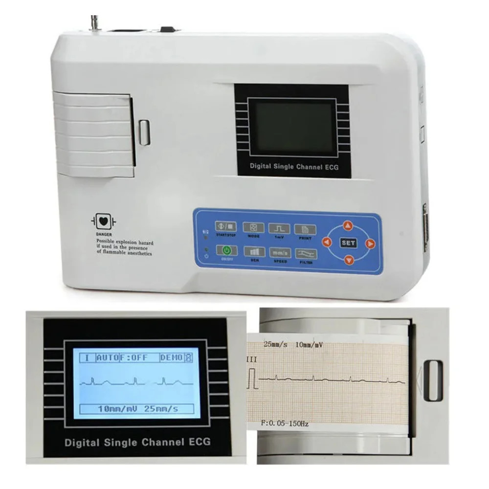 Medical ECG100G Electrocardiograph – 1-Channel 12-Lead Digital EKG Machine
