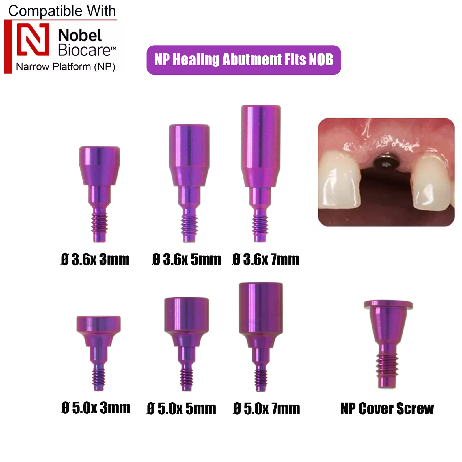 US Fits Nobel Biocare Kit Locator/Healing Abutments Scan Bodies Lab Analog NP/RP