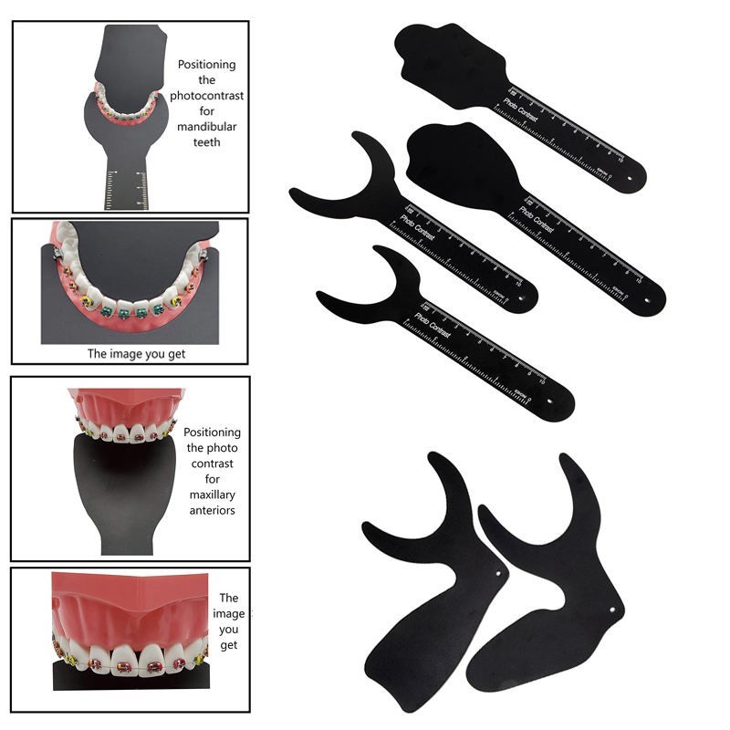 Orthodontic Oral Cheek Contrast Dental Photo Contrast Kit Dental Black Contrast