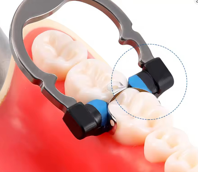 Dental Matrix Bands Ring Sectional Matrice Clamp Fit Garrison Palodent V3 System