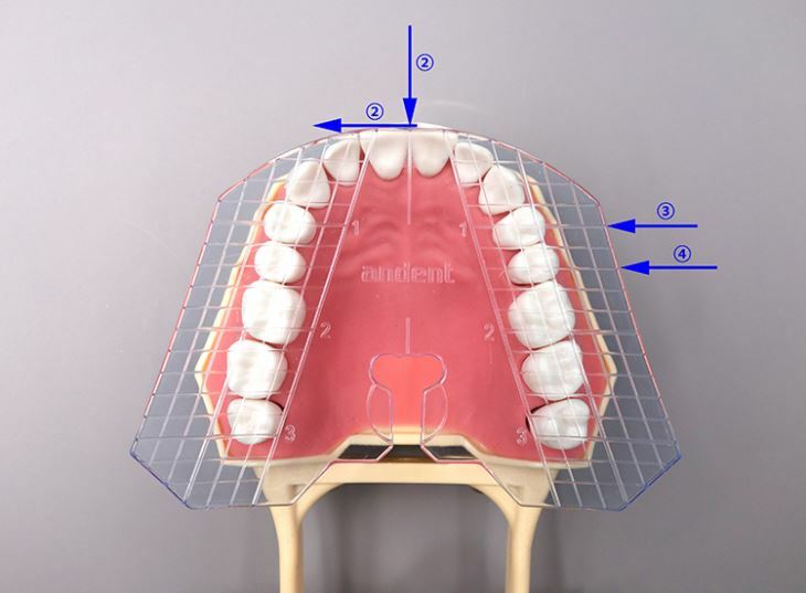Dental Guide Template Plate For Complete Denture False Teeth Arrangement
