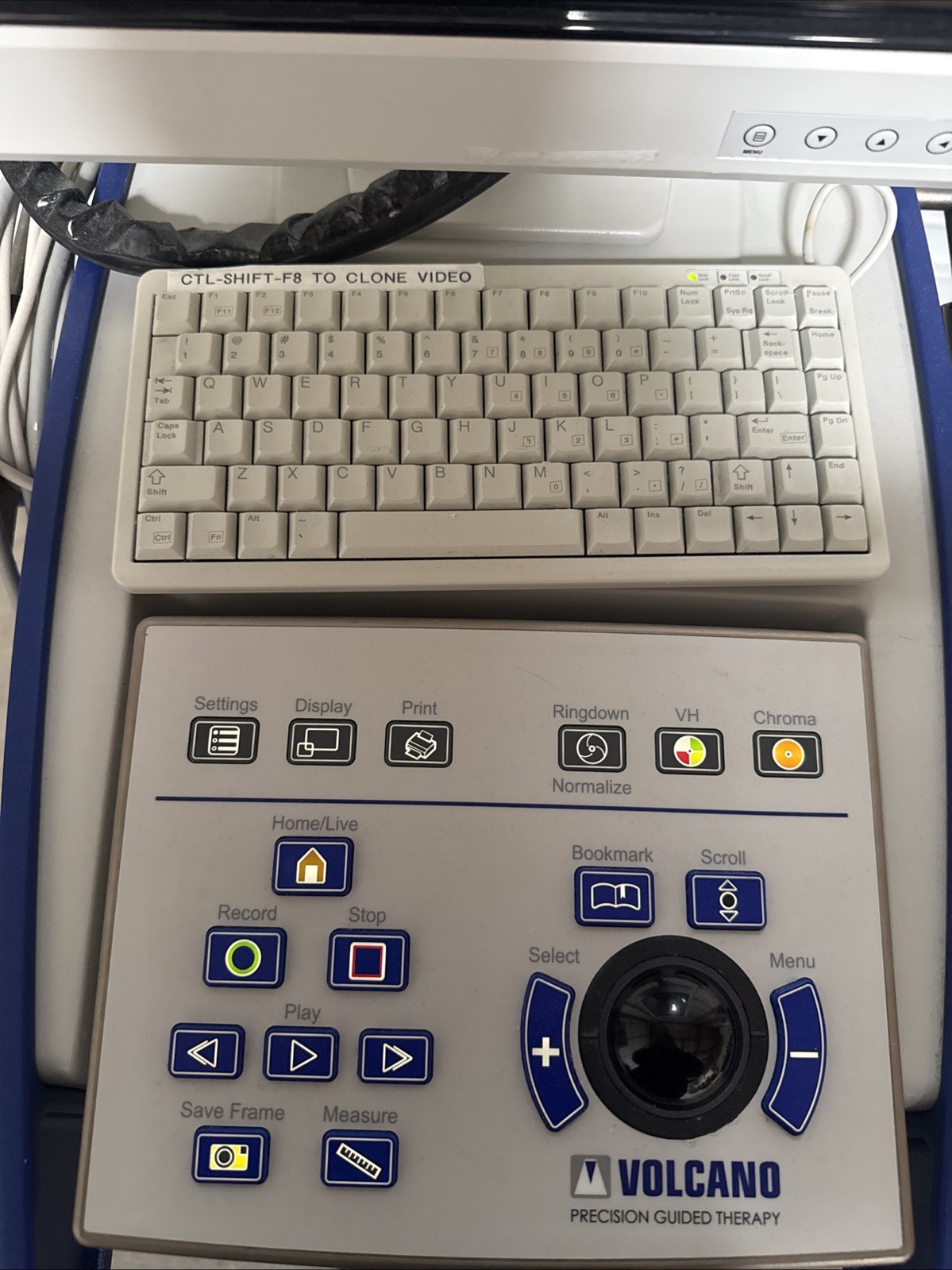 Philips Volcano CORE Mobile Precision Guided Therapy Navigation – No HD