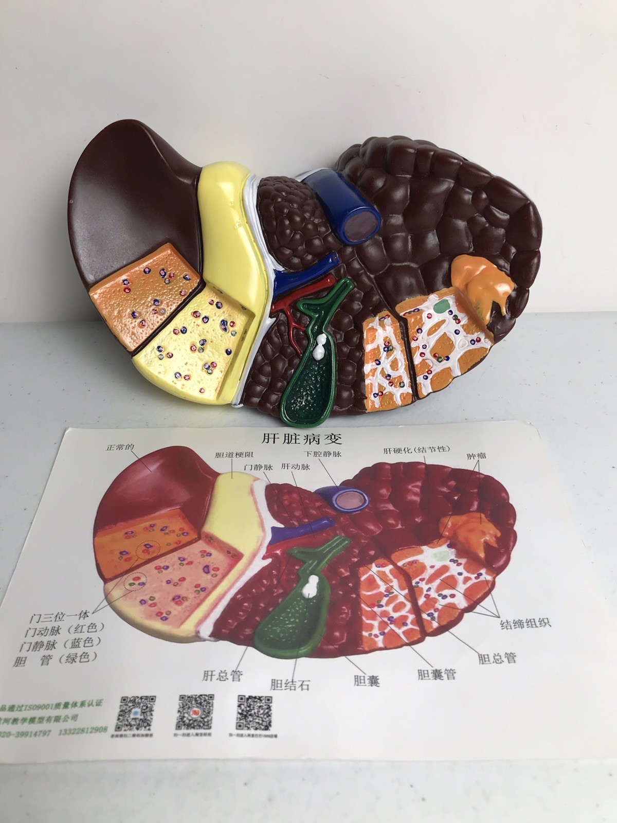 Pathological Liver Anatomical Model 1:1 Human Liver Model Anatomy Display Study