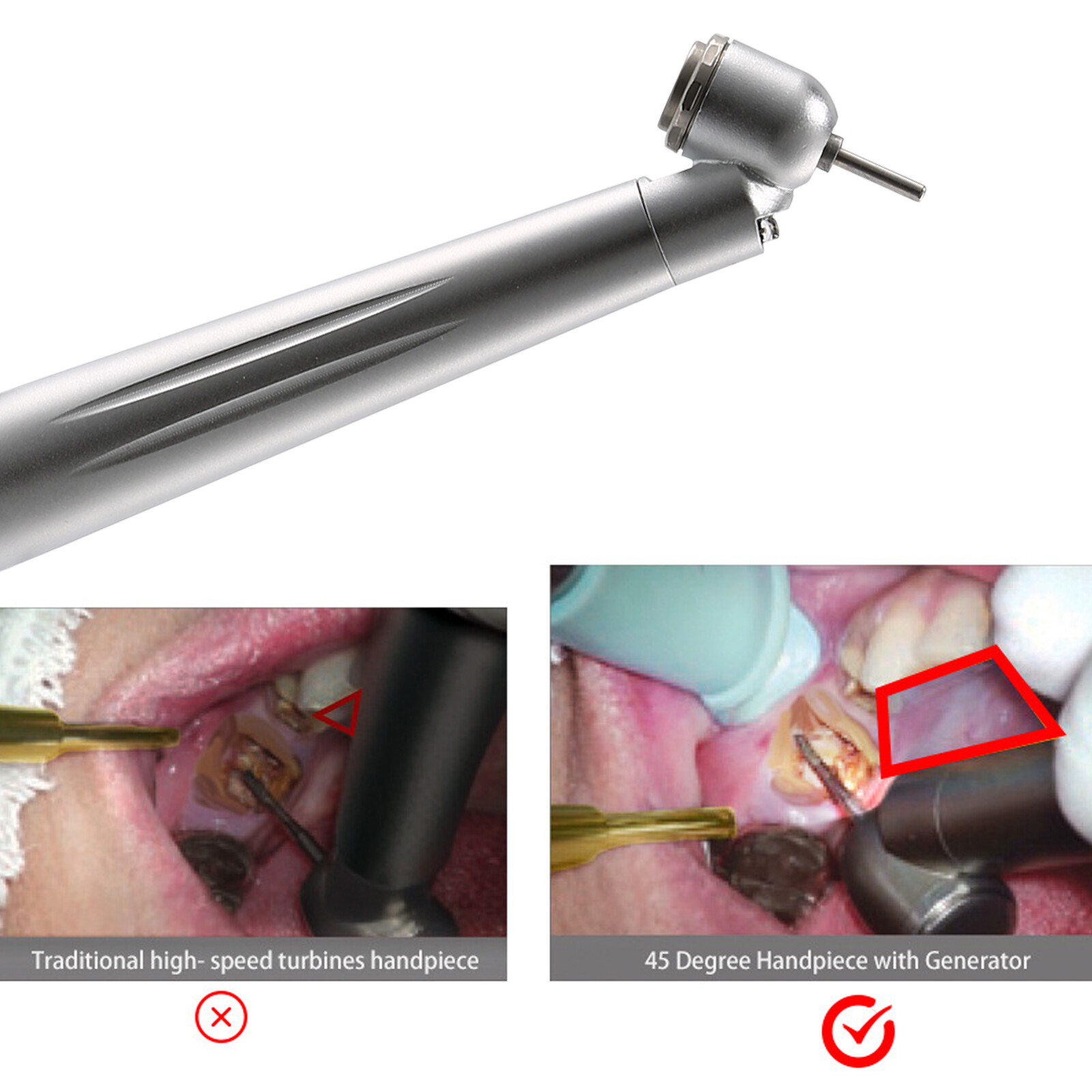 LED Dental Surgical Handpiece 45° Angle 4 Hole Midwest Rear Exhaust Impact Air